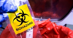 Toxicological evidence in an environmental contamination case