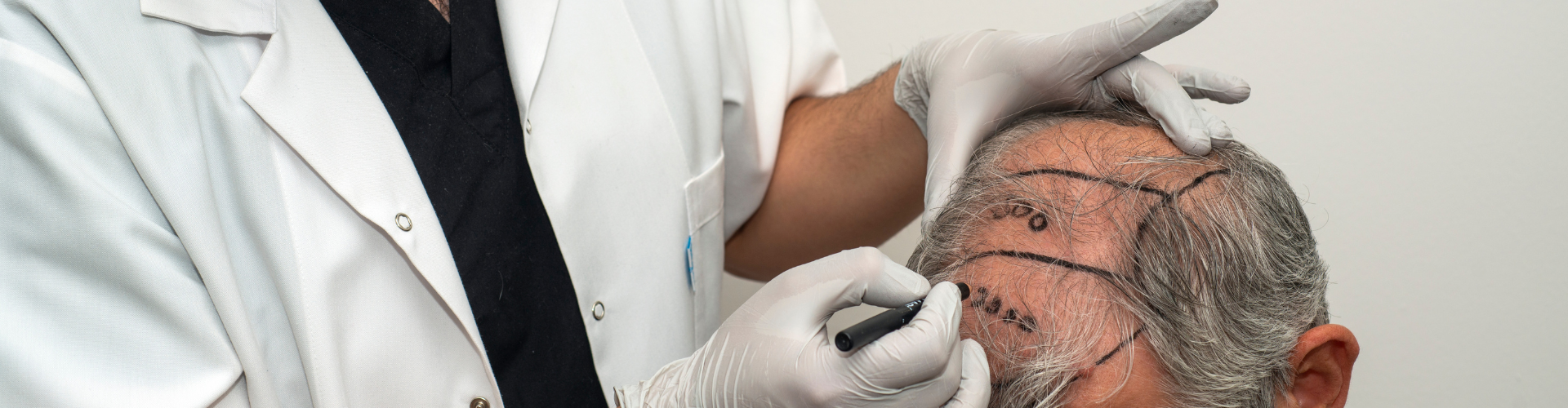 Is baldness a disease?