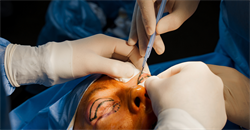 A Day in the Life of a Plastic, Aesthetic and Hair transplant Surgeon and Expert Witness