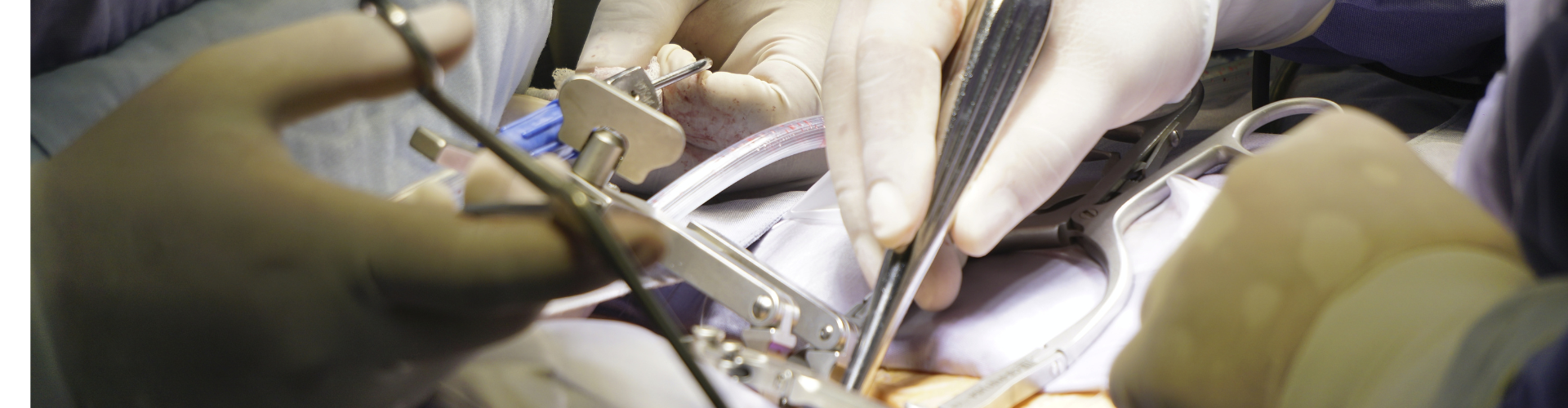 A Day in the Life of an Orthopaedic Spinal Expert Witness